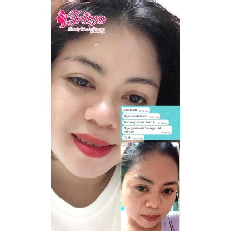 SKINCARE IRLIYA BEAUTY MENGATASI BERBAGAI MACAM MASALAH WAJAH