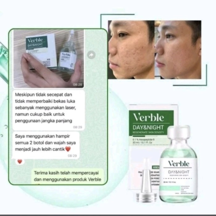 Verble Serum Bekas Luka Berlubang Verble Meregenerasi Kulit Baru