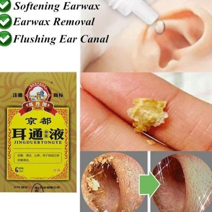 Promo Qinjie Drop Original / Solusi Telinga Bersih & Sehat Tanpa Kotoran