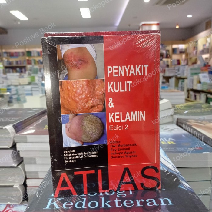 [COD] Atlas Penyakit Kulit Dan Kelamin Fk Unair Original Berkualitas
