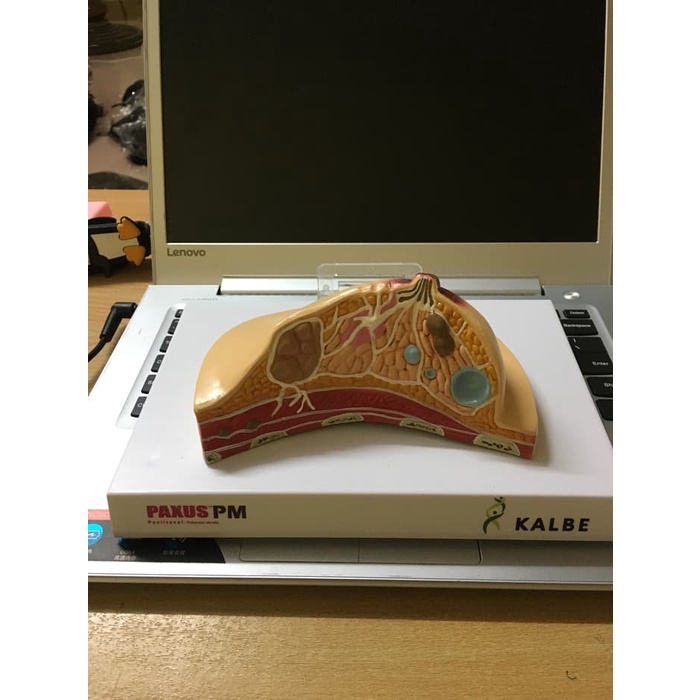 

Breast Common Pathologies Display Anatomi Payudara