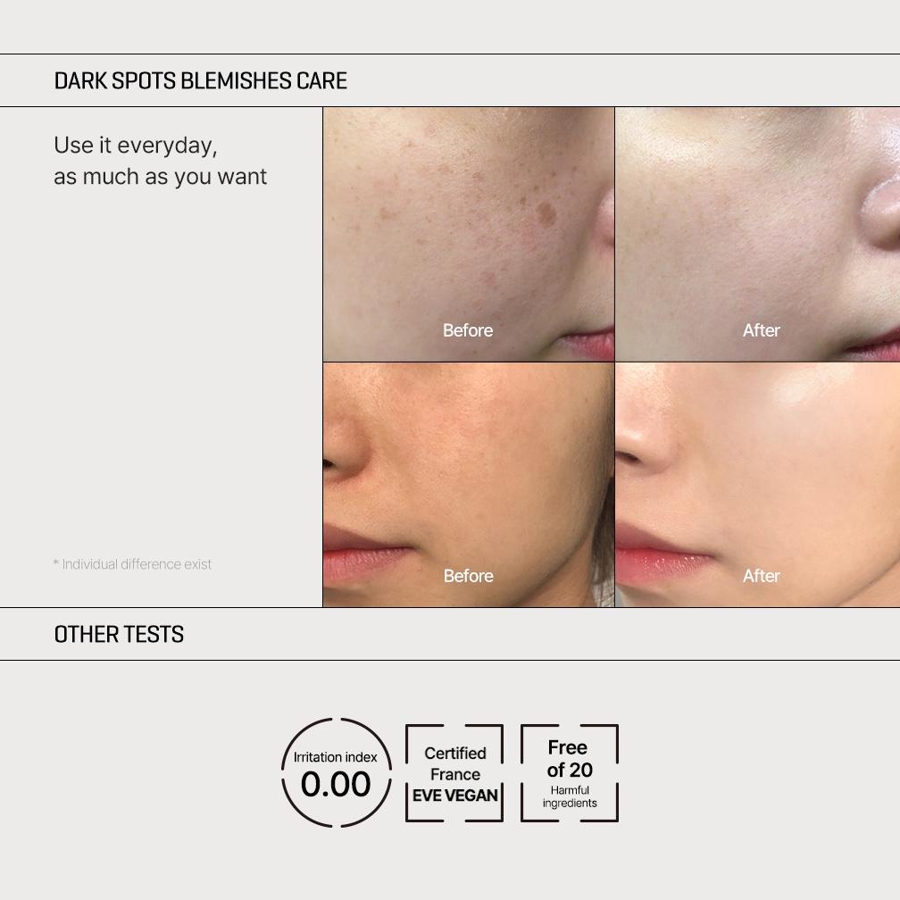 Terlaris [Mini Size] Some By Mi Yuja Niacin Dark Spot Correcting Stick 5G (Brightening All In One St