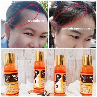 

Red Gingseng Hair Tonic Korea Menyuburkan Melebatkan Rambut Dalm 7 Hr