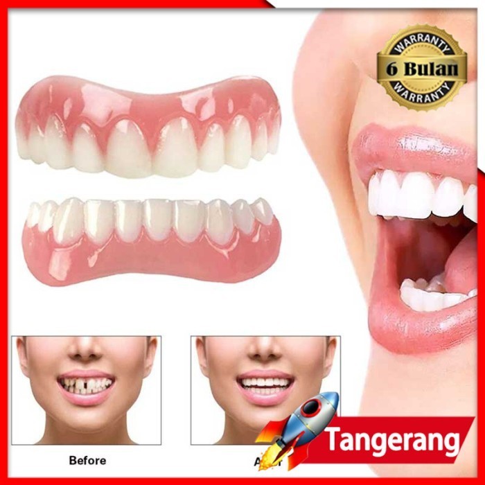 GIGI PALSU INSTAN PERFECT SMILE VENEER GIGI TIRUAN VENEER SILIKON