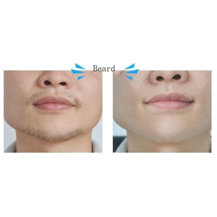 Original Koogis Krim Perontok Bulu Permanen Pria Wanita