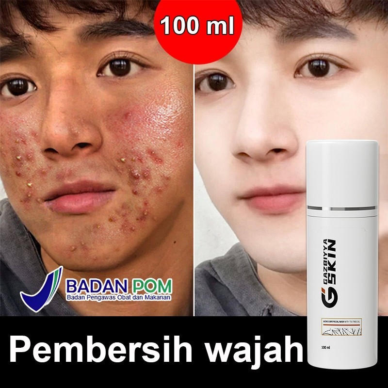 (Bpom) Pembersih Muka Pria Sabun Cuci Muka Pria Pembersih Wajah Obat Jerawat Dan Jerawat 100 Ml
