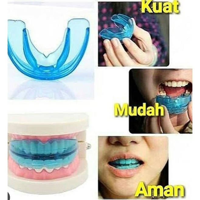 Behel Lepas Pasang Perapi Gigi Dental Teeth Trainer Bukan Kawat