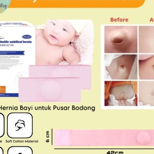 Hons Baby Umbilical Belt Hernia (Sabuk Hernia) Pusar Bodong