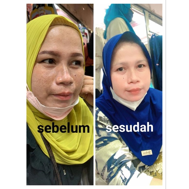 PAKETAN BANDEL FLEK