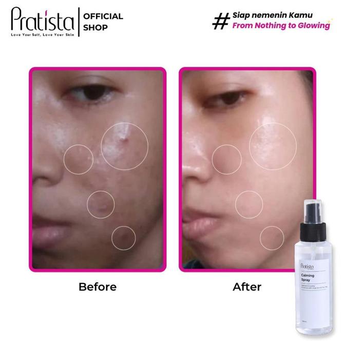 Ready Pratista - [2 Pcs] Calming Spray - 100% Original Limited Edition