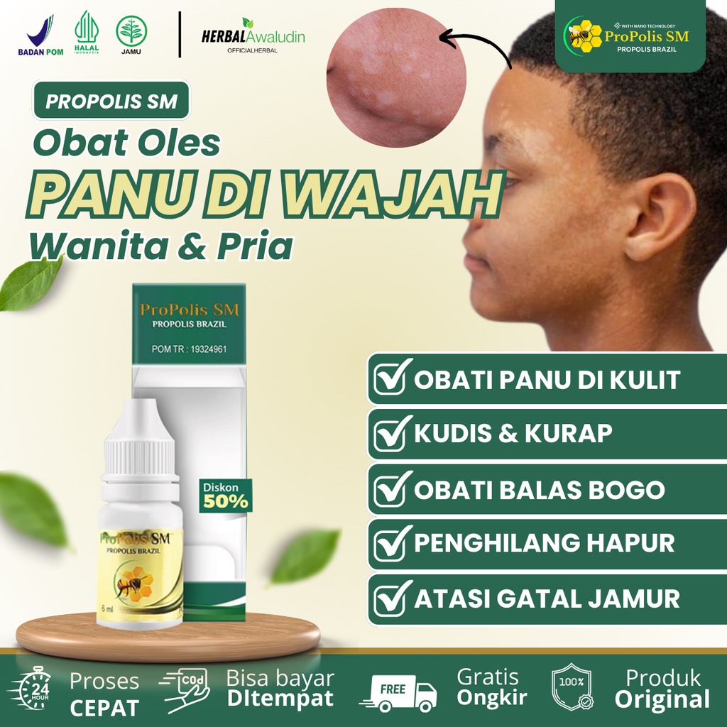 Obat Panu Cair, Obat Penghilang Panu, Obat Panu di Wajah, Balas Bogo, Obat Hapur, Obat Penghilang Be