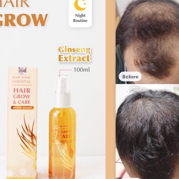 Hair Tonic Essential Kuning / Yellow 100 Ml - Hair Grow Umbuh Rambut Bpom (Beli 8 Gratis 1)