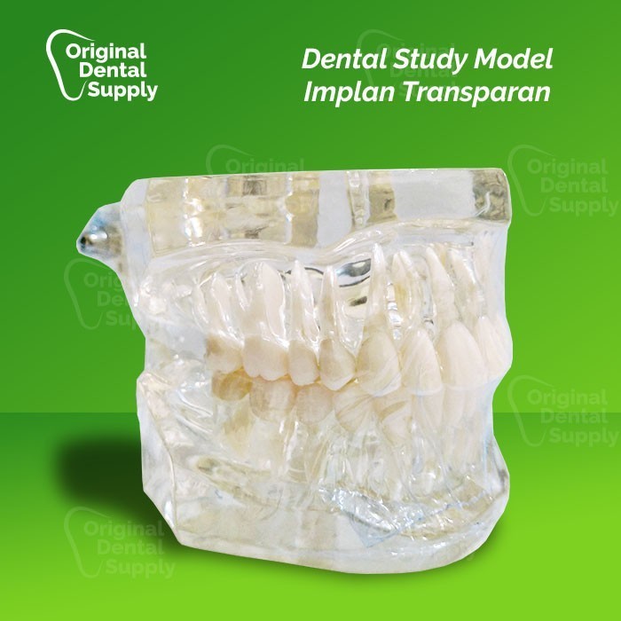 DENTAL STUDY MODEL IMPLAN TRANSPARANT TYPODONT PHANTOM GIGI