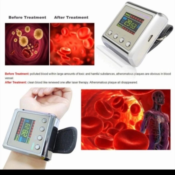 Jam Laser Terapi 7 / 12 Penyakit Stroke Jantung Diabetes dr IR Laser