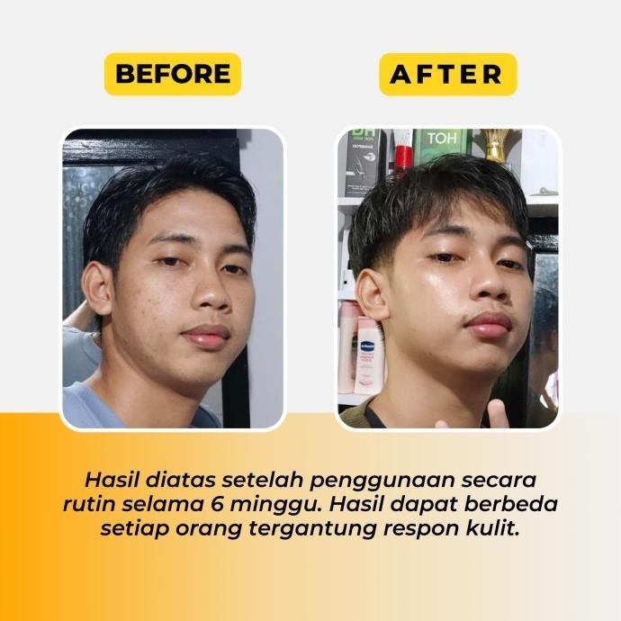 Octoskin - Paket Bundling 2 Pcs Octoskin Brightening Booster Serum