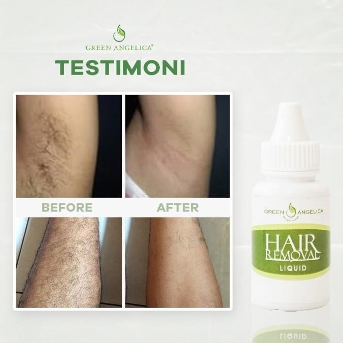 Perontok Bulu Permanen Alami Ampuh Tercepat Tanpa Iritasi & Sakit