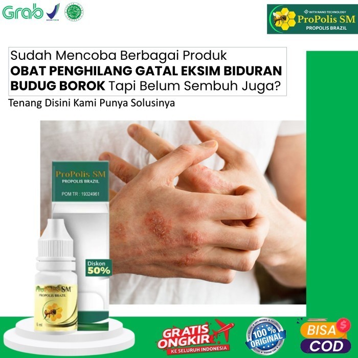 Obat Gatal-Gatal Penyakit Kulit Obat Eksim Menahun Propolis SM