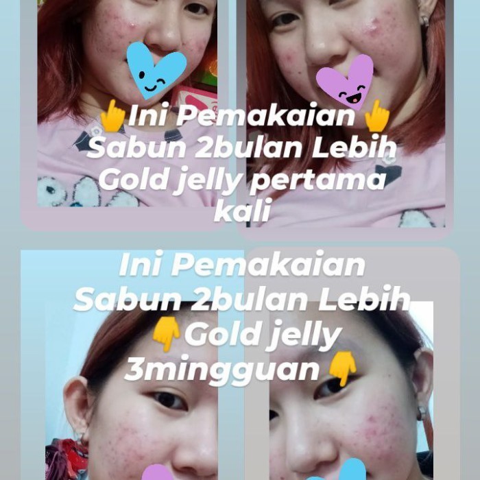 Paket Hemat Kedas Beauty Original / Cream Wajah Kedas Beauty 4In1