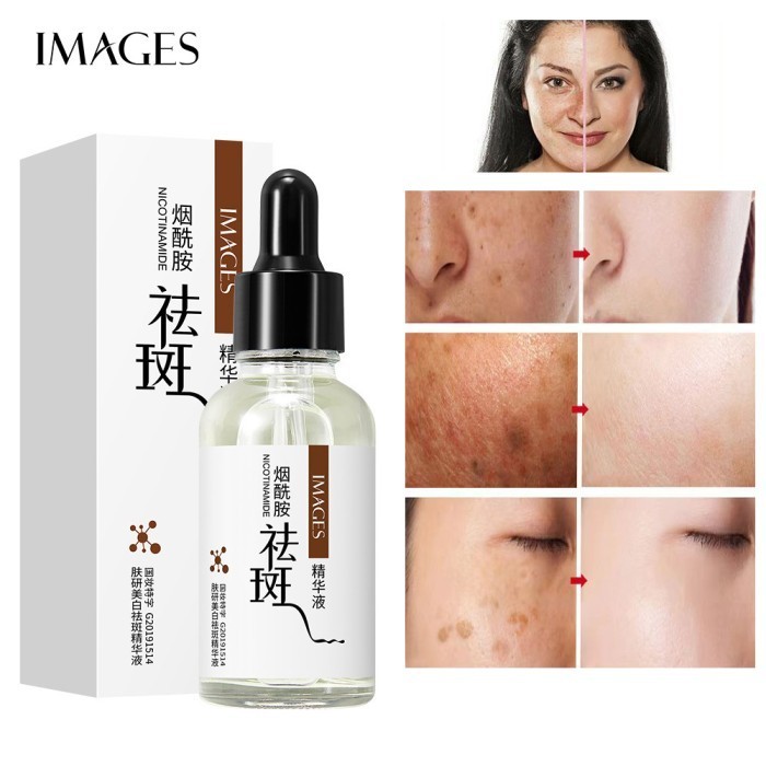 Best Images Freckles Whitening Serum Muka Hydrating Facial Essence Moisturizer Hymeys Niacinamide