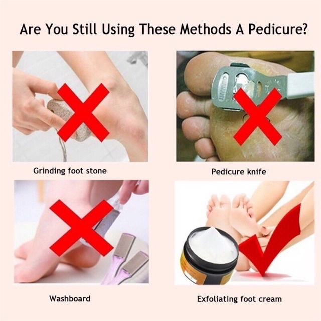 Krim Tangan Dan Kaki Nyak Kuda Perlindungan Beku Pelembab Tangan Dan Kaki Krim Yembuhan Kaki Retak