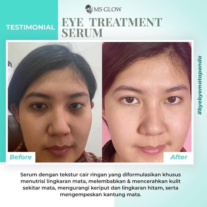 Eye Mask Eye Dark Circle Cream By Ms Glow (Solusi Mata Panda)