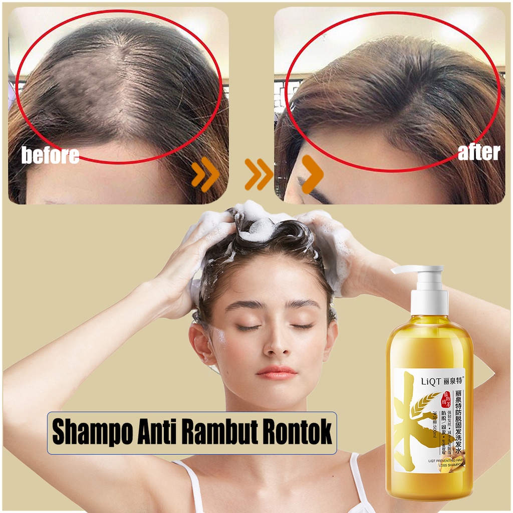Sampo untuk pertumbuhan rambut 500MLshampo anti ketombedan rontok sampo anti ketombe dan rontok mera