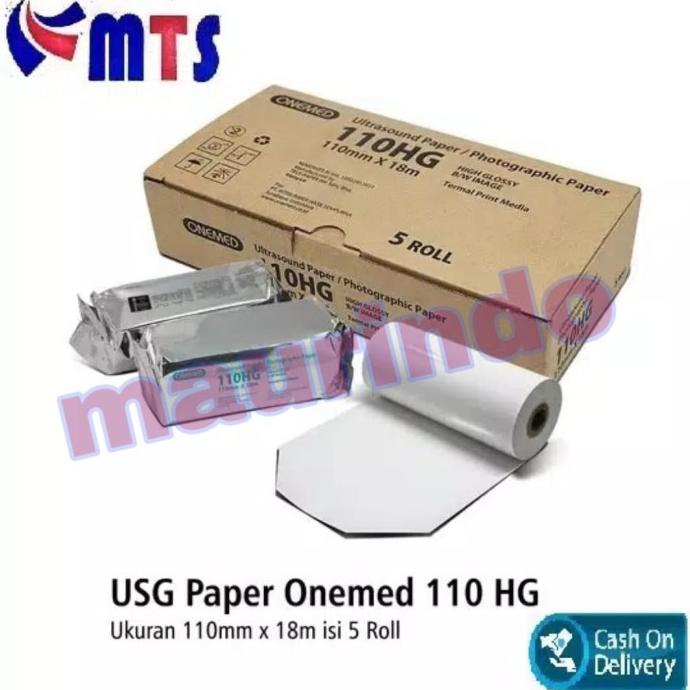 ris Ultrasound Paper Kertas USG Onemed USG Paper 110 HG Photographic Paper