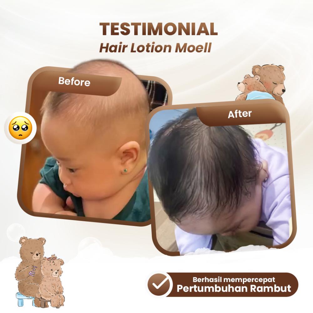 Promo Moell Special Bundling Body Lotion 185Gr &amp; Hair Lotion 100Ml - Skincare Baby - Natural Organic Aa88