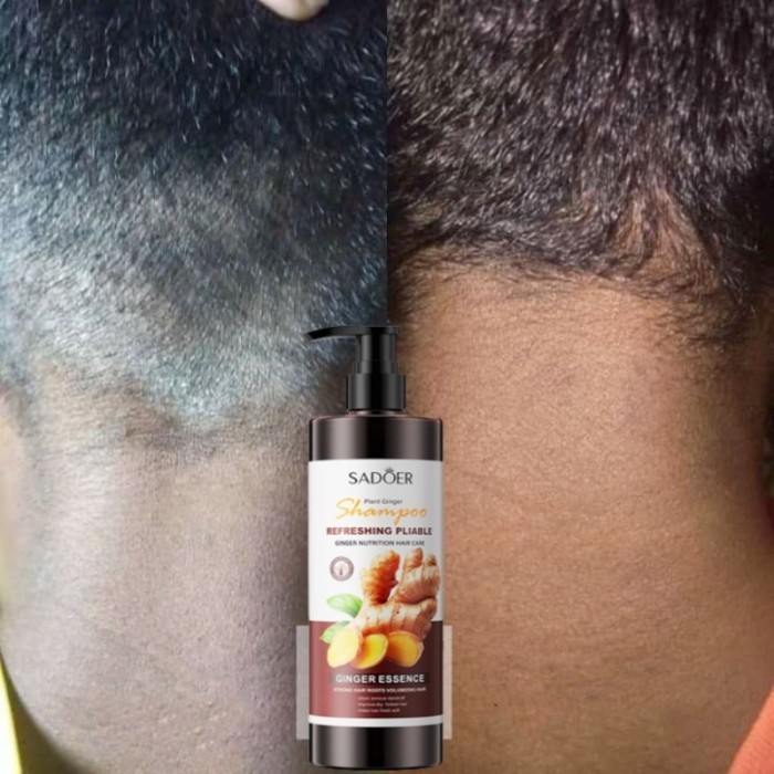 Terbaru Shampo Anti Ketombe Anti Ketombe Shampo Penghilang Kutu Anti Ketombe Promo Terlaris