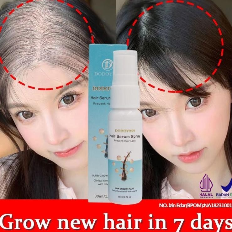 [Bpom] Umbuh Rambut Cepat Obat Umbuh Rambut Serum Umbuh Rambut Umbuh Rambut Botak 30Ml Kontrol Nyak 