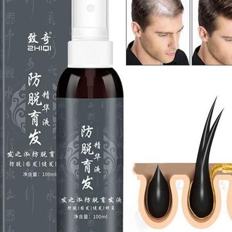 Hair Growth Serum Spray Obat Umbuh Rambut Botak Rontok Pria Wanita Ampuh Cina Tradisional - 100Ml
