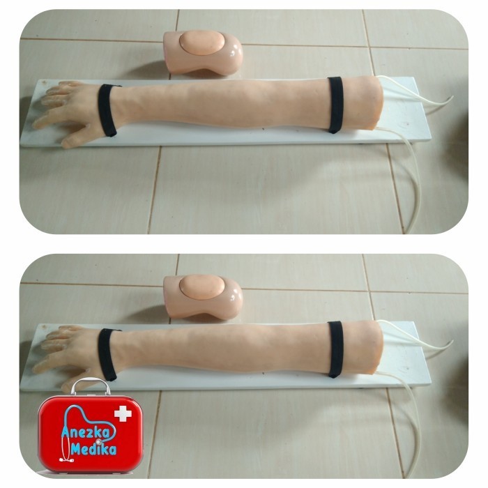 PHANTOM/MANIKIN/Alat peraga Tangan infus/Manekin tangan infus