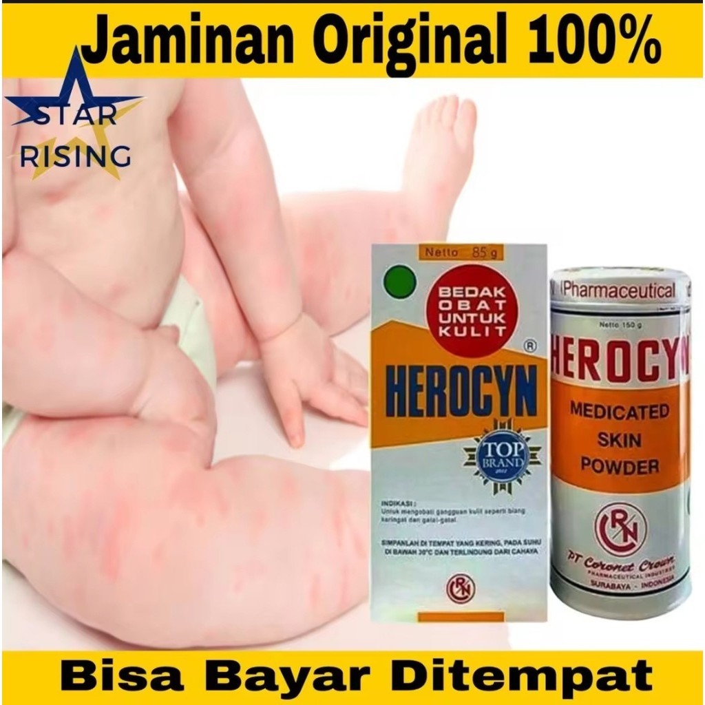 Bedak Herocyn / Bedak buat gatal gatal pada kulit . biang keringat bedak Bayi / Bedak buat Gatal-gat