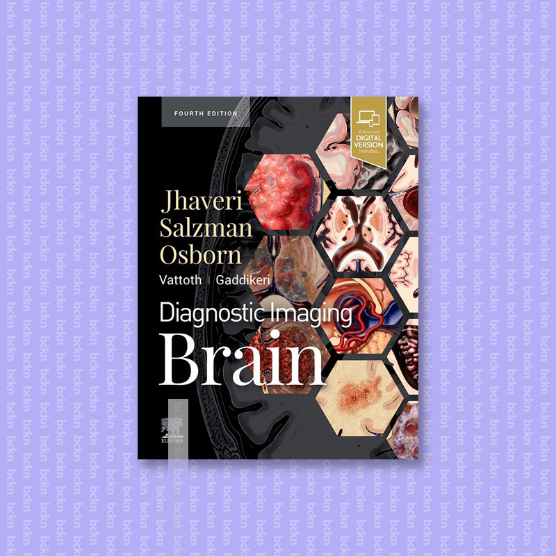 

Diagnostic Imaging - Brain - Miral D. Jhaveri