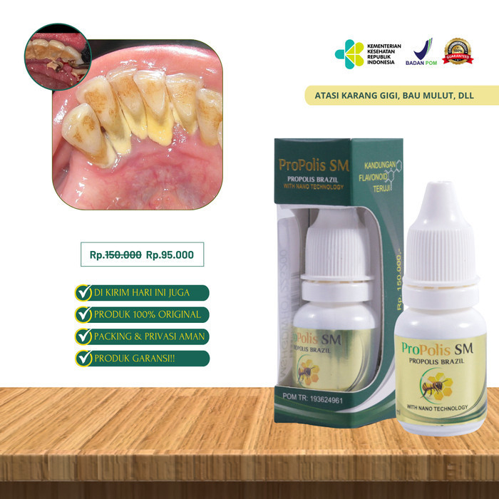 Pembersih Karang Gigi Ghilang Karang Gigi Membandel Pembersih Karang Gigi 6Ml Pemutih Gigi Kuning