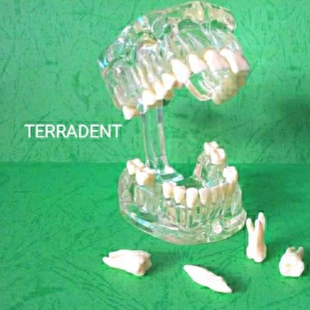 GH Duradent model gigi Dental Study Model Phantom Gigi bisa di lepas transparan TERLARIS