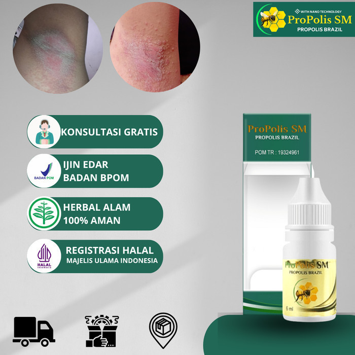 HOT SALE Penghilang Gatal Merah Pada Ketiak, Ketiak Iritasi, Alergi Deodoran