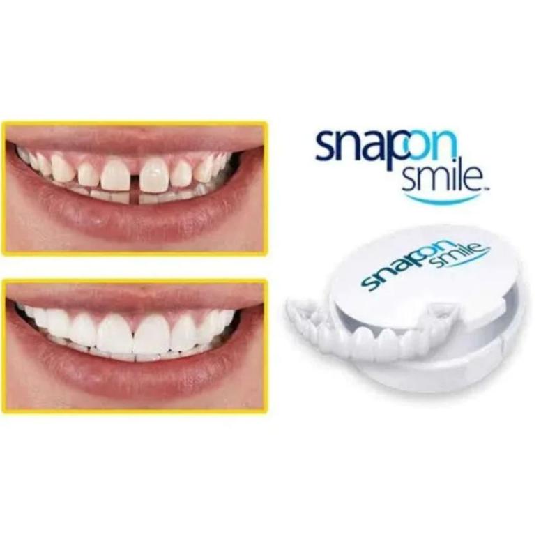 Update! Snap On Smile Gigi Palsu Instan Atas Bawah 100% ORI Perapi Gigi Ompong Renggang Patah ~