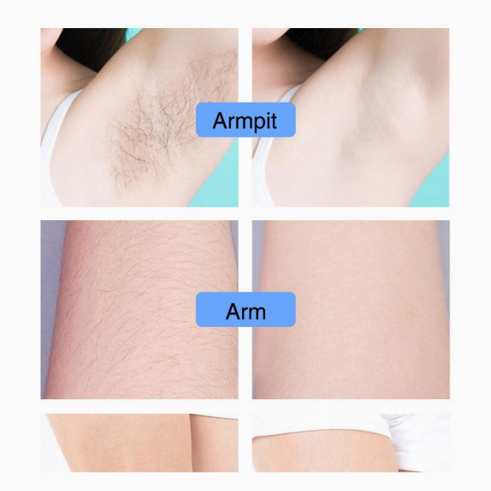 Cream Waxing - Hair Removal Cream Daerah Pribadi Miss V Perontok Bulu Kemaluan Waxing