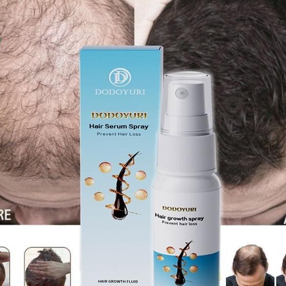 [Bpom] Umbuh Rambut Cepat Obat Umbuh Rambut Serum Umbuh Rambut Umbuh Rambut Botak 30Ml Kontrol Nyak 