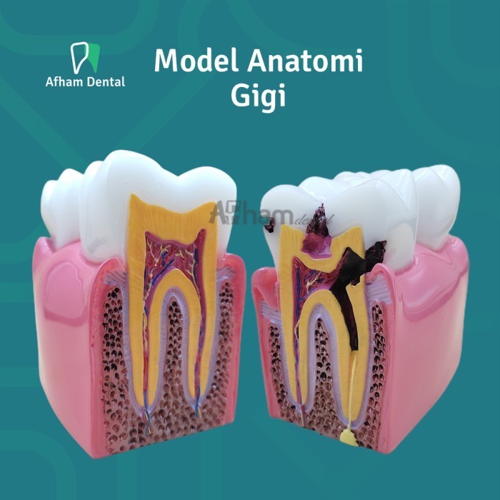 

Model Anatomi Gigi 6 Kali Untuk Belajar / Kompetisi / Edukasi Dokter