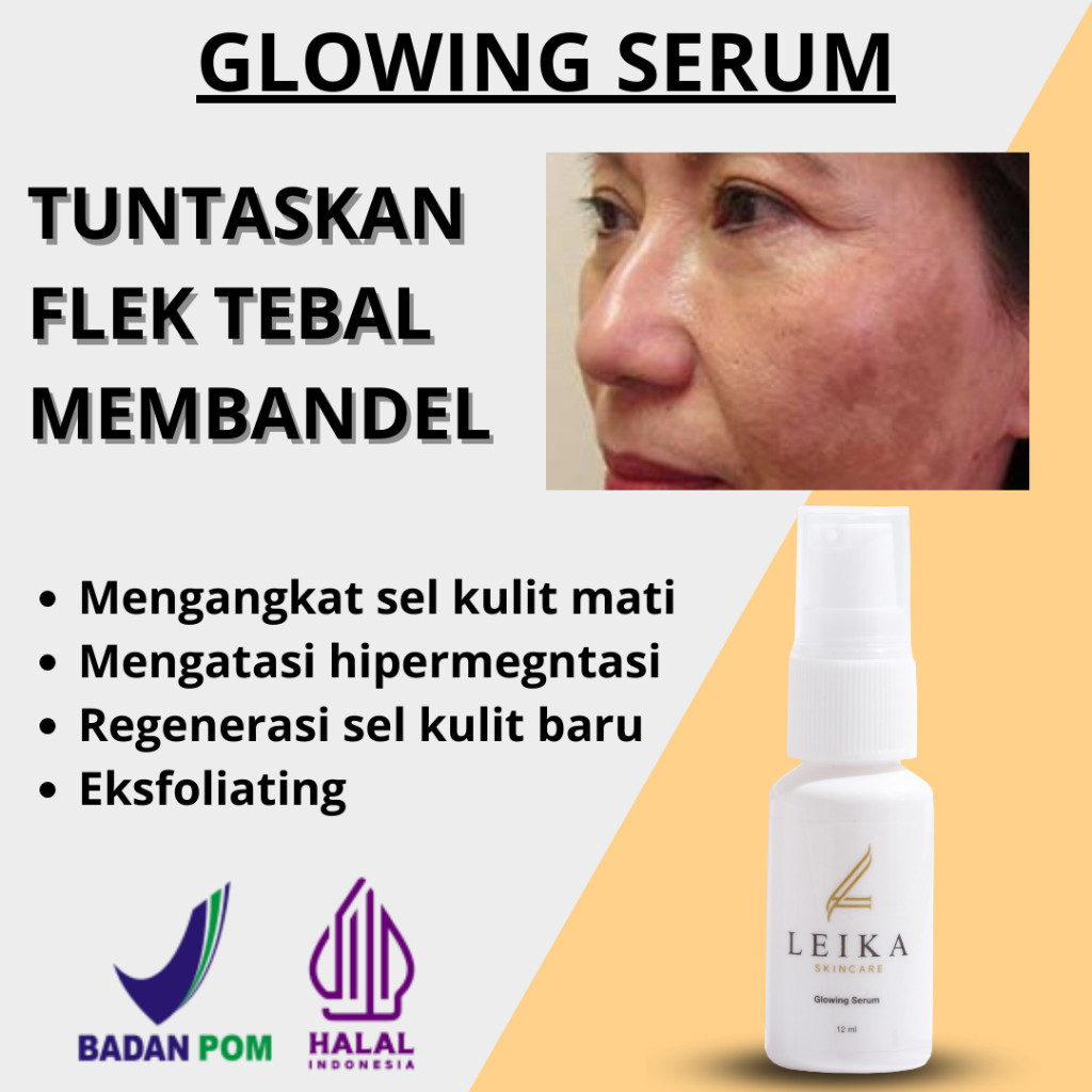 Serum Leika Skincare Glowing Ghilang Flek Hitam Membandel Bpom Serum Lightening Ghilang Jerawat Bog