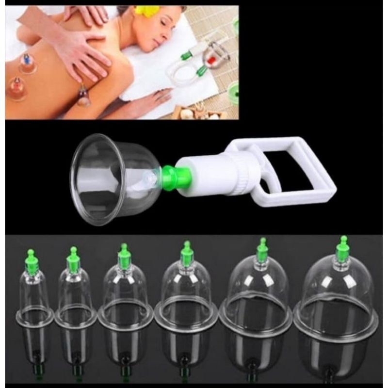 Kop Angin 6 Pcs Alat Kop Bekam 6 Cup Alat Terapi / Alat Bekam Kop Angin isi 6pcs Vacum Cupping