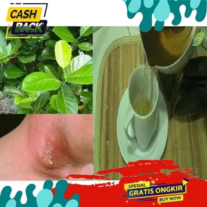 

SALE 30 LEMBAR DAUN NANGKA OBAT ALAMI DIABETES.