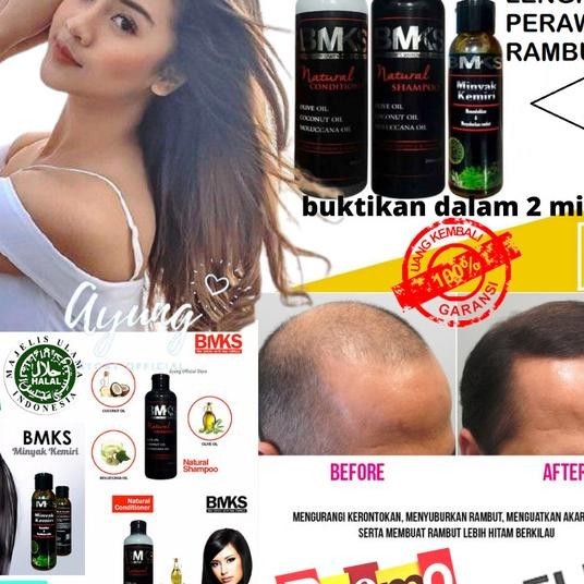 Umbuh Rambut Botak Bmks Nyak Keri Conditioner Shampo Bpom