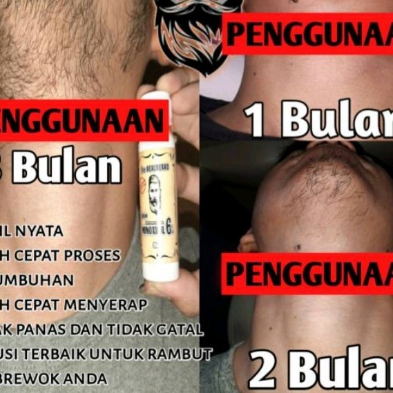 PENUMBUH RAMBUT, MINOXIDIL BREWOK TANPA GEN ORIGINAL 100%