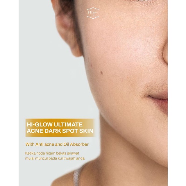 PAKET HI GLOW SKINCARE (100%ORIGINAL) - ULTIMATE SERIES ISI 5 ITEM ( DAY CREAM, NIGHT CREAM, SERUM, SUNSCREEN, FACIAL WASH ), GLOW / ACNE DARK SPOT/ ACNE PRONE / REMOVE SPOT / ORIGINAL BPOM HALAL