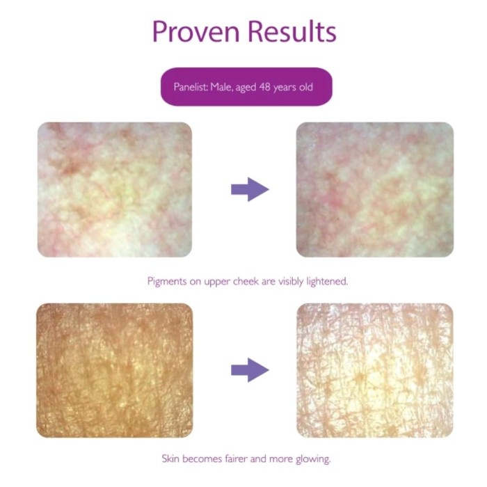 Kinohimitsu Prowhite Glutathione 30 Sachet