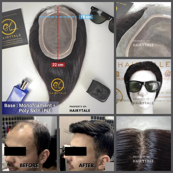 Toupee/Tutup Botak Pria, Natural 20Cm, Luas 22X15, 100% Hair