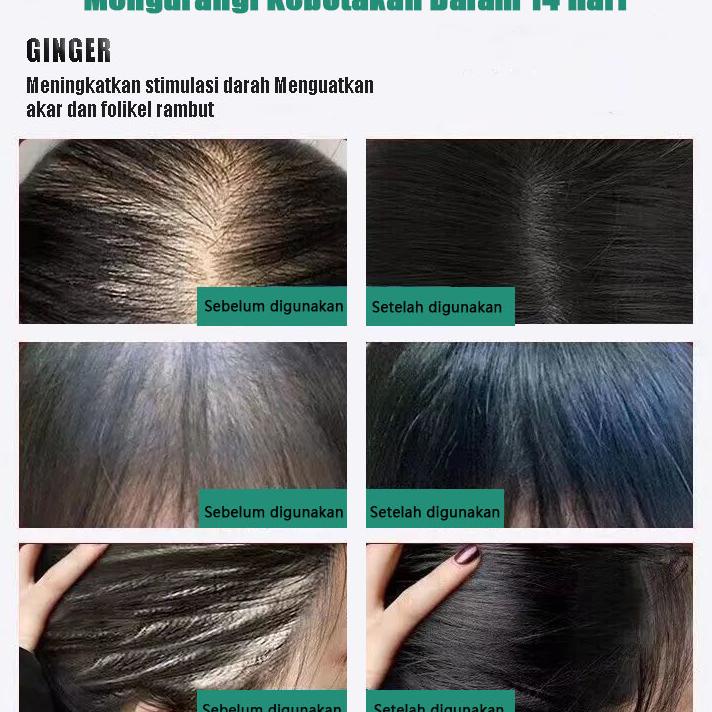 Zhenxiu Sampo Jahe Produk Res Shampo Pertumbuhan Rambut Cepat Rambut Rontok Serum Rambut Rontok, Per